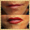 creating fuller lips
